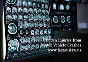 South Florida Accident Attorneys